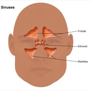How To Get Rid Of Sinus Inflammation - A Help Guide Sinusitis Treatment