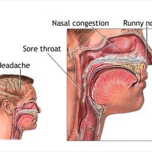 Sinus Causes Light Headed - What To Do When Your Sinus Medicine Fails You