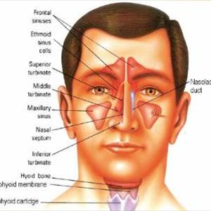 Cures For Sinusitis - Cures With Regard To Sinusitis Relief