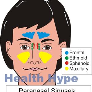 Sinuvil Herbals - Types Of Candica Sinusitis